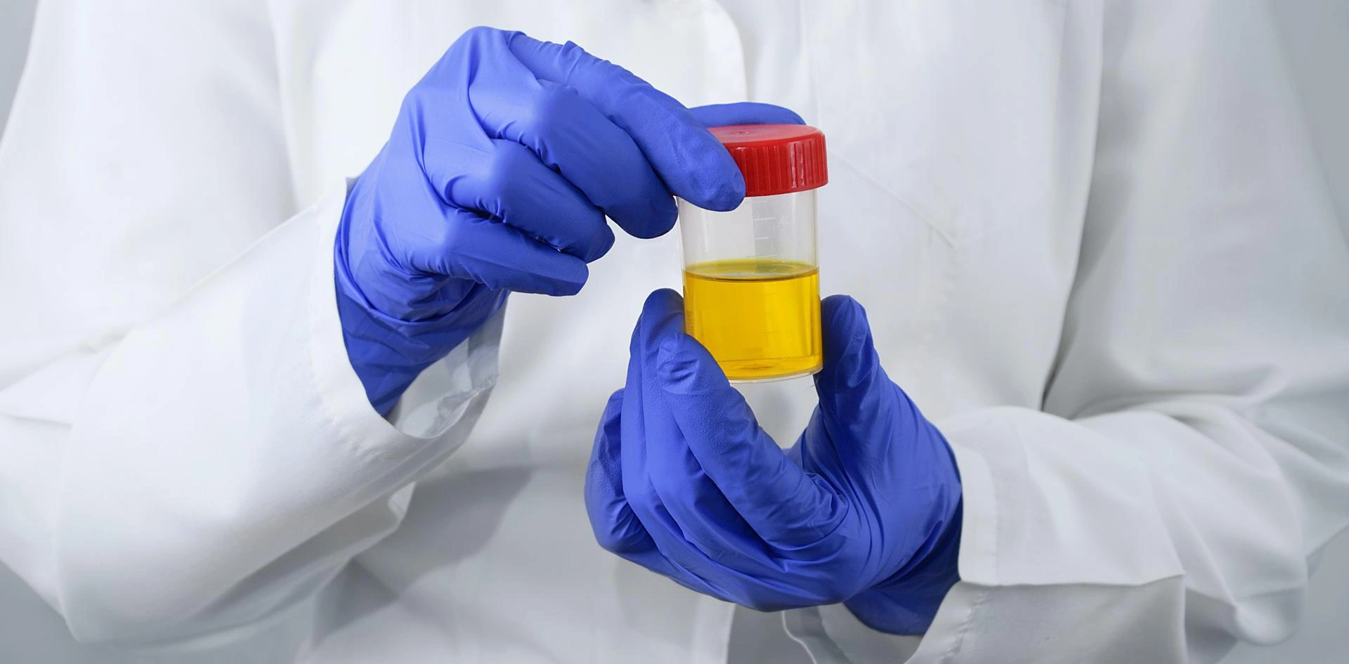 Secure Design Business with Drug Cup Testing